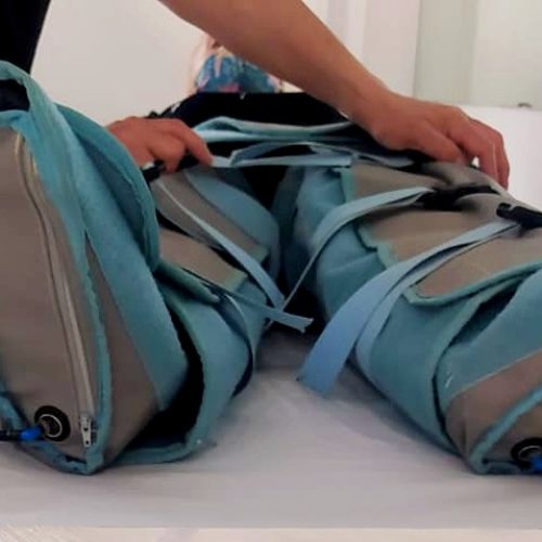 PRESO1 Botas de presoterapia aplicadas en una paciente